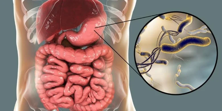 Ilustrace žaludku s bakterií Helicobacter pylori