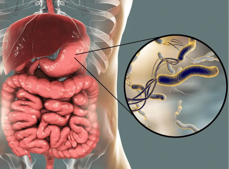 Helicobacter pylori v žaludku, zvětšený pohled na bakterie