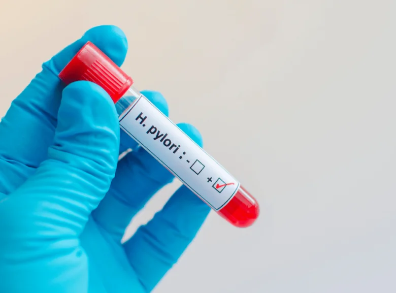Test na Helicobacter pylori – pozitivní výsledek
